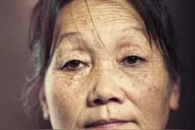 人老了，为什么有老年斑？如何淡化去除？3种方法告知您图片