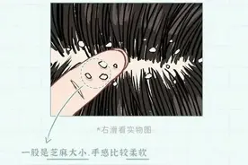 头皮上的“白色颗粒”是什么？漫画告诉你，管不住手的下场会怎样图片