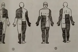 外科手术消毒、铺巾操作，做好这几个细节事半功倍图片