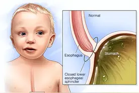 关于 “婴儿吐奶” 的问题图片