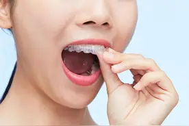 网上买的牙套能不能用？真的能矫正成功吗？图片