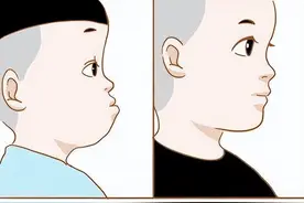 告别拖累颜值的“地包天”，口腔医生有话说~图片