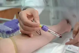 孩子发烧，是病毒性感染还是细菌性？可以看看血常规上这3个数据图片