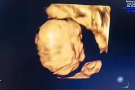 孕23周，四维用时两天，医生说宝贝很好看👼🏻图片