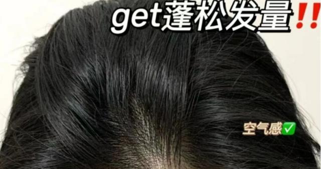孕期还跟风乱用洗发水？阿道夫脱发不控油，飘柔控油但长头屑