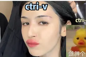 一不小心成了香肠嘴，这个夏天蚊子有点“猖狂”啊！图片