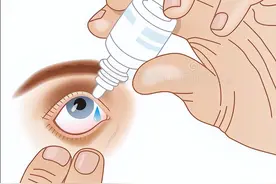 上海眼科院长科普：这三种眼药水不能长期使用，对眼睛伤害大！图片