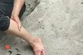 40分钟身亡？广东一村民被眼镜王蛇咬伤不幸身亡！这蛇有多毒？图片