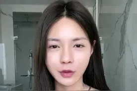 沈梦辰素颜被嘲像男人！鼻头肿胀山根明显，脸上惊现多处整容疤痕图片