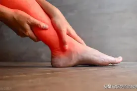 腿部就是你的“血糖仪”，若频繁出现这5种怪象，多半血糖超标了图片