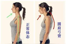 肱骨前移怎么调整？图片