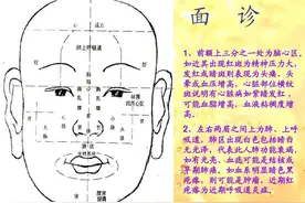 常见的面部对应的表现，自我诊断方法图片