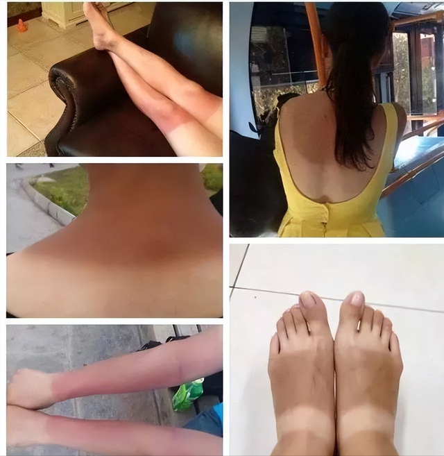 天天都涂身体乳