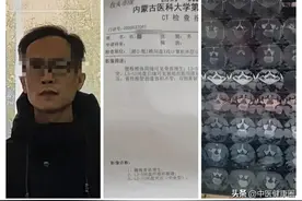一张金匮要略方，巧治腰突有奇效，免手术了！图片