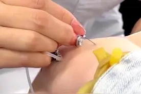 医院护士戴美甲给患者扎针，“指甲上还有金属链条”，院方回应图片