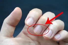 为何有的人指甲上有月牙，有的人没有？指甲上的月牙与健康有关吗图片