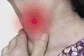 慢性咽炎，咽喉不适，咽干咽痒，异物感，推荐四味药图片