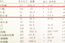 胆红素反映肝脏代谢能力，胆红素指标升高，提示有肝损伤图片