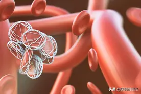 血栓来临，手脚先知？提醒：手脚若出现4种异常，或许血栓已来临图片