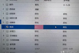 尿隐血2+会是什么问题？一定要了解这2个指标和这3点建议图片