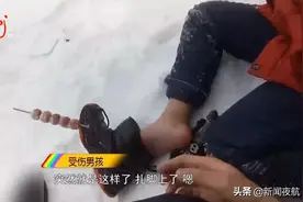 揪心！黑龙江一10岁男孩脚背扎进了一串冰糖葫芦图片