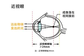 趣味科普丨动物也会近视吗图片