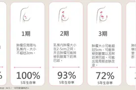 乳腺癌病理报告到底该如何看？教你读懂乳腺癌病理报告单图片