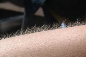 体毛太多能刮掉吗？这两处体毛尽量不要刮，别害羞，早了解早受益图片