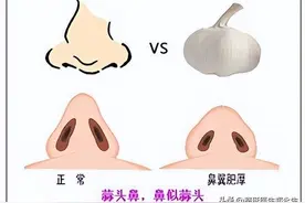 为什么鼻子丑的人无法特别好看？这7种丑鼻子，希望你没有中招图片