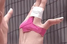 骨折后，不疼了就算是完全好了吗？图片