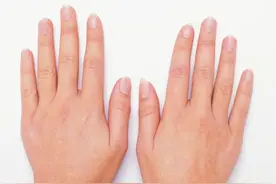 指甲盖上有竖纹，是咋回事？真是老人说的“肝脏不好”吗？图片