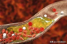 58岁张叔查出慢性肾衰竭，原因：擅自将辛伐他汀换成瑞舒伐他汀图片