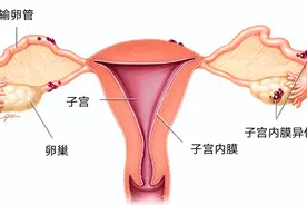 胚胎最爱什么样的内膜？怎么把薄内膜养成好内膜！图片