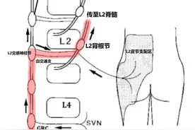 腰椎间盘病变引起腹股沟区、臀部或睾丸牵涉痛的传导通路图片