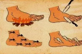 糖尿病神经病变的表现有哪些？图片