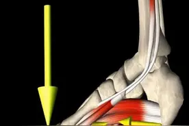 足大拇指不能弯曲，疼痛，不能有力把地，原因？怎么应对呢？图片