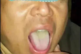 滋阴法治疗舌苔厚腻图片
