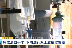 13岁女孩全身85%烧伤后续报道：完成清创手术 下周进行双上肢植皮覆盖图片