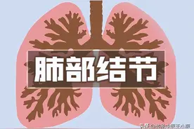 再顽固的肺结节，也怕3个药，清肺散结，止咳化痰，结节散的干净图片
