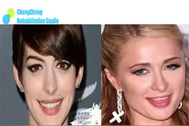 轻松告别“大小眼”、双眼无神！【干货教程】图片