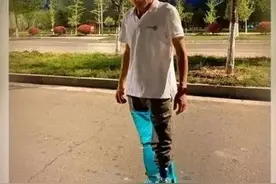 90后硬核小伙在自己腿上整花活儿，装充电接头、七彩LED灯……网友：发现野生钢铁侠图片