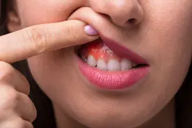 烤瓷牙是能变美还是真翻车？烤瓷牙性价比起底大公开图片