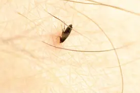 跳蚤一般咬完人都藏哪？怎么找到跳蚤？快速找到并消灭跳蚤的办法图片