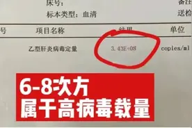 乙肝病毒量高低看这个数值就够了图片