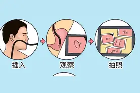 协和科普：胃肠镜检查详细攻略，9类高危人群建议必查图片