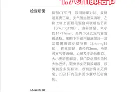 34岁的她切除了1.7cm肺结节，术后50天仍气短气喘，感觉伤了元气图片