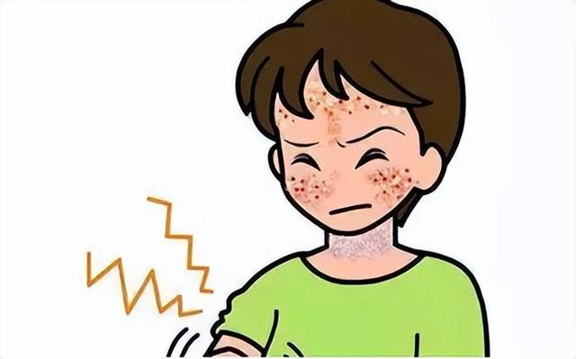 老年性角化病严重吗