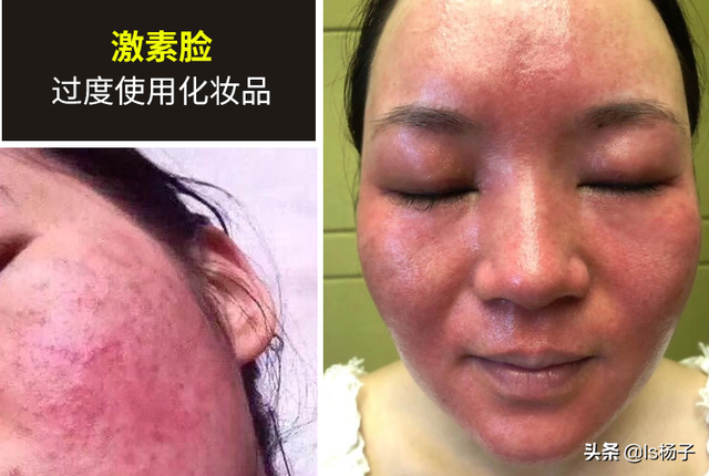 有没有什么一瓶就可以代替多瓶的只擦一种就可以的护肤品？（精）