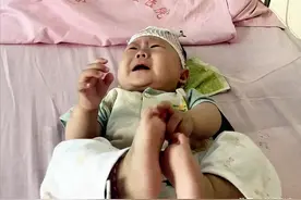 5月大女婴长红疹被查出血癌，为安抚孩子打针，妈妈抱了一年多图片