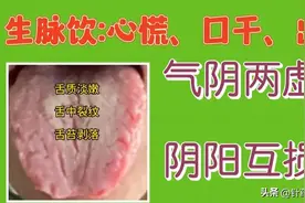 生脉饮:舌象与功效图片
